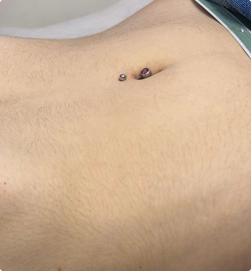 Piercing Left View